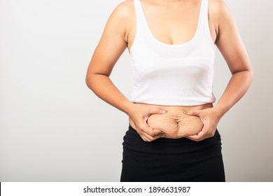 Close Up Of Asian Mother Woman Showing Stretch Mark Loose Lower Abdomen Skin She Fat After Pregnancy Baby Birth, Studio Isolated On White Background, Healthy Belly Overweight Excess Body Concept