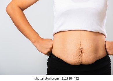 Close Up Of Asian Mother Woman Showing Stretch Mark Loose Lower Abdomen Skin She Fat After Pregnancy Baby Birth, Studio Isolated On White Background, Healthy Belly Overweight Excess Body Concept