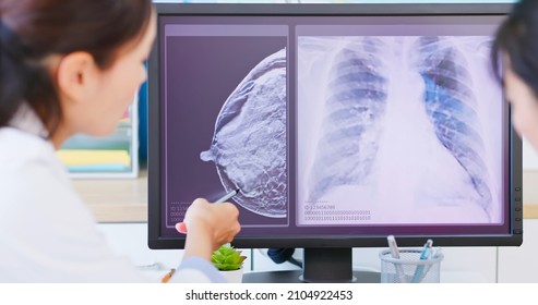 close up of asian woman has breast cancer diagnosis in hospital - female doctor showing mammography test results and xray to patient on computer