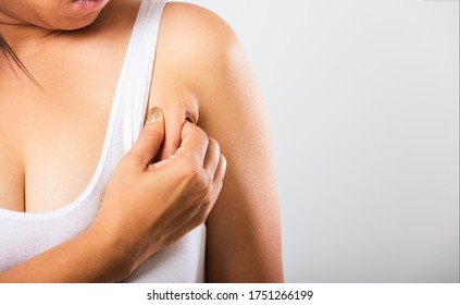 Close Up Of Asian Woman Pulling Excess Fat On Her Skin Underarm She Problem Armpit Fat Underarm Wrinkled Skin, Studio Isolated On White Background, Healthy Overweight Excess Body Concept.