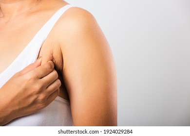 Close Up Of Asian Woman Pulling Excess Fat On Her Skin Underarm She Problem Armpit Fat Underarm Wrinkled Skin, Studio Isolated On White Background, Healthy Overweight Excess Body Concept