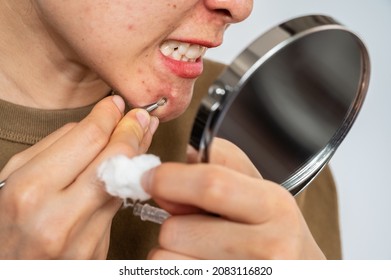 Close up of Asian woman trying to squeezing acne by using double headed acne needle while looking mini mirror. Conceptual shot of Acne and Problem Skin on female face.