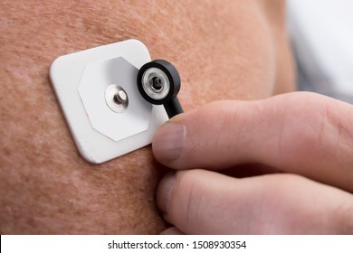 Close Up Of Attaching L Lead To  An Electrocardiography ECG EKG Electrode For A Heart Monitor