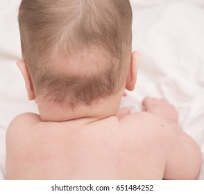 Close Up Of Baby Bald Patch