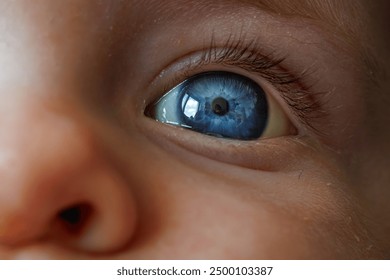 close up of baby blue eye iris with jaundice - Powered by Shutterstock