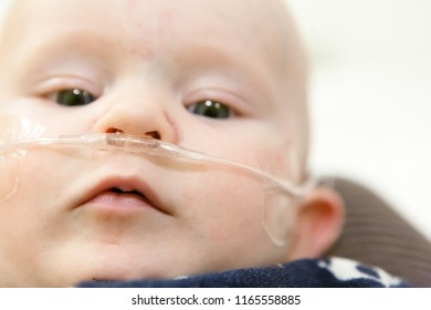 A Close Up Of A Baby With A Breathing Tube In Their Nose Receiving Medical Treatment.