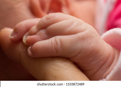 Close Up Of Baby Girl Hands, With Syndactyly. Medical Condition, Webbed Fingers