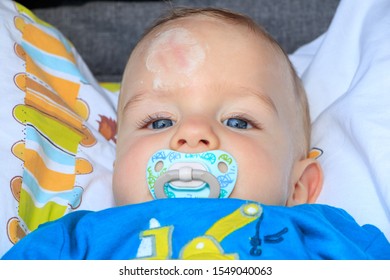 Close Up Of Baby Injury. Baby's Expression And The Scar On The Forehead After He Hits His Head On The Ground. 