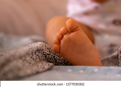 Close Up Of Baby Legs And Feet, Syndactyly Condition On Foot Toes, Webbed Toes