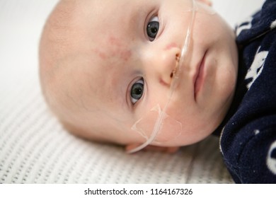 Close Up Of Baby With Tube In Nose To Deliver Oxygen.