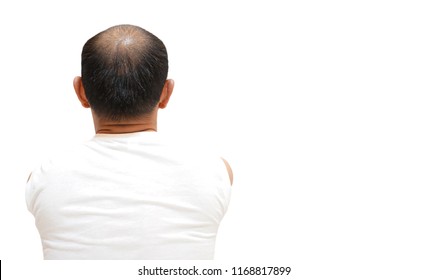 Close Up Back View Of A 35 Year Old Bald Man With White Shirt And White Background.               