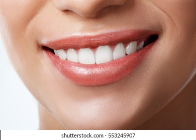 Close Up Of Beautiful Wide Smile Of Young Fresh Woman With Great Healthy White Teeth. Isolated Over White Background