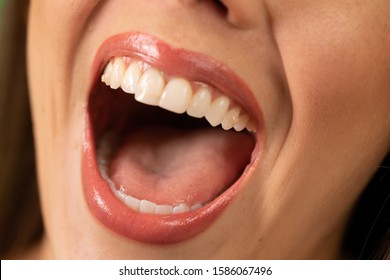 Close Up Of A Beautiful Woman's Open Laughing Mouth. Young Woman With Perfect Teeth Smiling