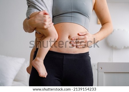 Close up of a belly with scar from c-section. A woman holding a baby showing her imperfect body. An abdomen with scar from Caesarian section. Imagine de stoc © 