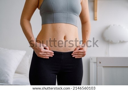 Close up of a belly with scar from c-section. Women's health. A woman dressed up in sportswear demonstrating her imperfect body after a childbirth with nursery on the background.