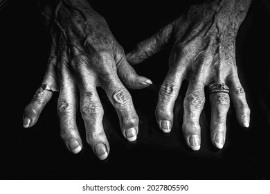 A Close Up Black And White Image Of An Elderly Woman's Arthritic Hands. She Is Wearing A Diamond Ring And Her Knuckles Are Swollen. Her Nails Are Nicely Painted. 