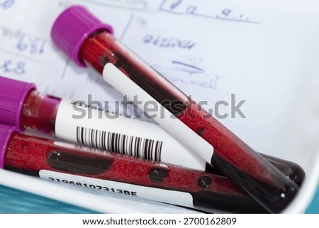 Close up of blood samples in test tubes with barcode labels and purple caps placed on medical documents in a laboratory, representing health testing, diagnostics, and medical analysis concept.