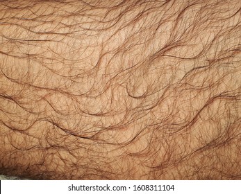 Close - Up Of Body Hair ,  Hairy Leg
