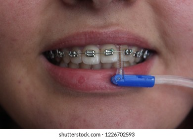 Close Braces Background Stock Photo 1226702593 | Shutterstock