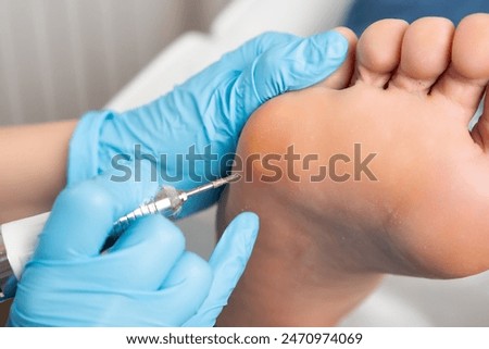 Close up callus removal using electric drill on a womans foot at the medical center