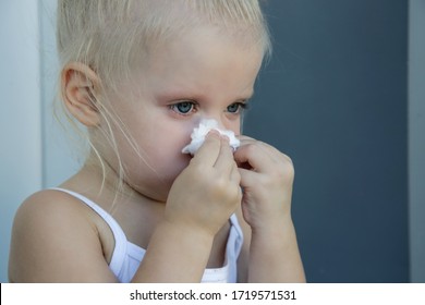 Close Up Candid Portrait Of Toddler Girl Blowing Nose. Runny Nose Caused By Cold, Flu Or Allergy.