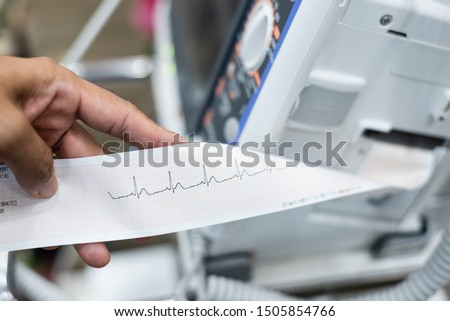 Close up of cardiologist doctor  holding and reading ekg paper print report of heart disease patient in the operating room before operation.Seriously case heart patient monitoring concept.