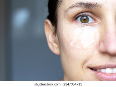 Close Up Of Caucasian Girl, Woman With Natural No Makeup Look And White Teeth Smile, Take Off Or Has Silicone Eye Patches. Smiling, Excited, Happy Woman, Home Skincare, Dark Circles. Looks Up