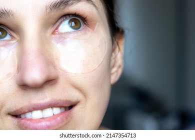 Close Up Of Caucasian Girl, Woman With Natural No Makeup Look And White Teeth Smile, Take Off Or Has Silicone Eye Patches. Smiling, Excited, Happy Woman, Home Skincare, Dark Circles. Looks Up