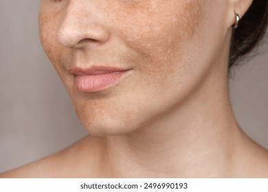 Close up caucasian woman's face with freckles or age spots photo. Age spots on the face close up photo - Powered by Shutterstock