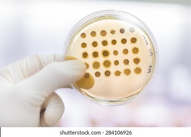 Close up of cell culture samples on LB agar medium in petri dish.  Agar plates are used by biologists to culture cells, mold, fungi, bacteria or small moss plants.
