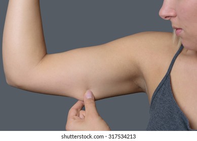 Close up Conscious Young Woman Holding Excess Fat on her Arm Against Grey Wall Background.