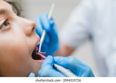 Close up cropped photo of curing healing operating teeth tooth, filling mouth cavity against caries decay dentist orthodontist in dental clinic. Stomatology concept - Shutterstock ID 2094319726