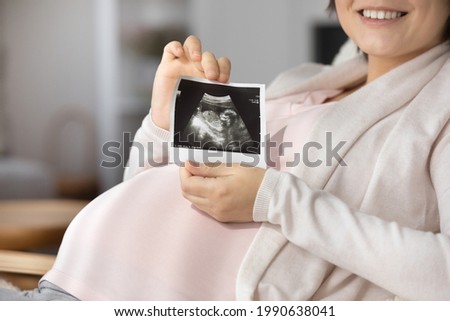 Close up cropped of smiling pregnant woman showing ultrasound picture at camera, happy beautiful young future mom demonstrating scan, waiting for first baby, pregnancy and motherhood concept