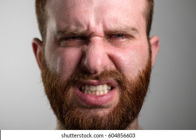 Close Up Of A Crying Angry Man With Red Beard