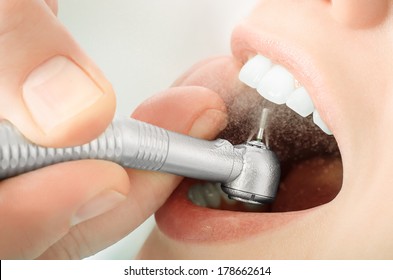 Nahaufnahme eines Zahnarztes, der die Zähne bohrt und das Wasser sprüht