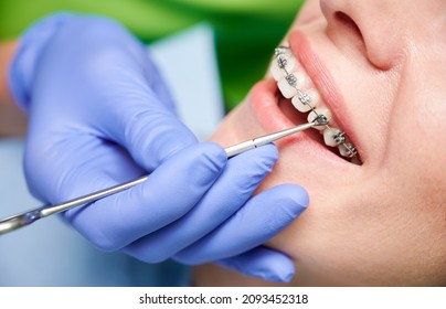 Close up of dentist hand using dental forceps while putting orthodontic braces on female patient teeth. Woman having dental procedure in clinic. Concept of dentistry and orthodontic treatment. - Shutterstock ID 2093452318