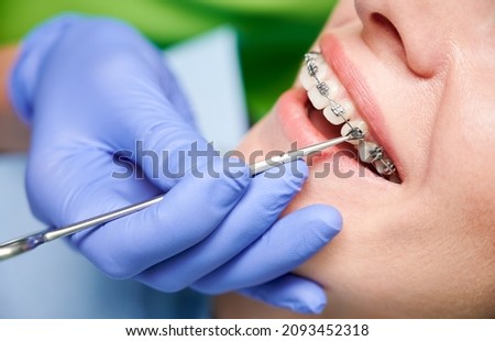 Close up of dentist hand using dental forceps while putting orthodontic braces on female patient teeth. Woman having dental procedure in clinic. Concept of dentistry and orthodontic treatment.