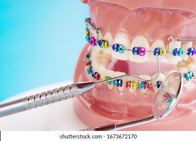 Close up dentist tools and orthodontic model  - demonstration teeth model of varities of orthodontic bracket or brace - Shutterstock ID 1673672170