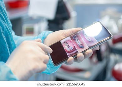 Close Up Of Dentist Wearing Protective Clothes And Gloves While Showing Patient’s Jaw And Braces On Phone.