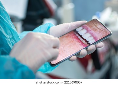 Close Up Of Dentist Wearing Protective Clothes And Gloves While Showing Patient’s Jaw And Teeth On Phone.