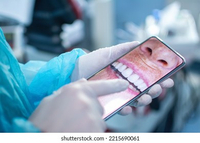 Close Up Of Dentist Wearing Protective Clothes And Gloves While Showing Patient’s Jaw And Teeth On Phone.