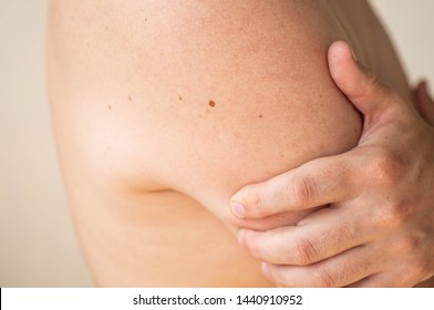 Close Up Detail Of The Bare Skin On A Man Back With Scattered Moles And Freckles. Checking Benign Moles. Sun Effect On Skin. Birthmarks On Skin