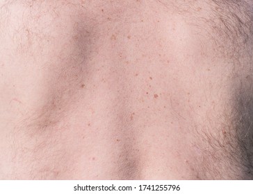 Close Up Detail Of The Bare Skin On A Man Back With Scattered Moles And Freckles