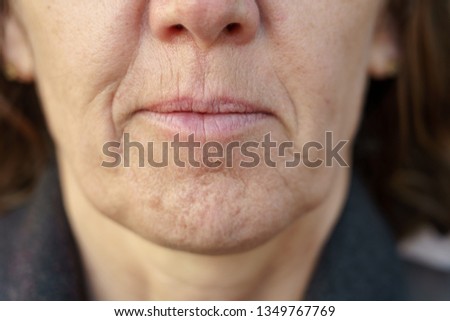 Close up detail of the chin of a middle-aged woman without makeup showing the wrinkles and dimpling of the skin associated with ageing