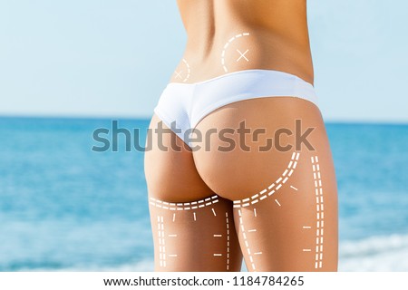 Close up detail of female buttock with surgical contour lines.Areas on shin marked with dotted lines for liposuction surgery. 
