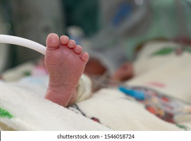 close up details of a premature baby´s foot still in an incubator at the NICU. Heroic concept. Surviving.