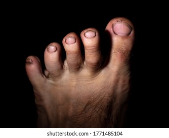 dirty black feet