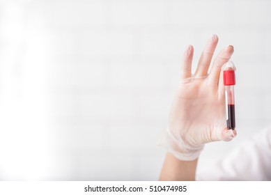 Close up of doctor hand holding blood sample. Copy space in left side
