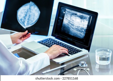 Close up of Doctor reviewing mammography results on x-ray and typing results on laptop.