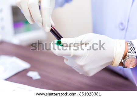 Close up of the doctor's hands holding a test tube. scientist's hand with a tube of blood.